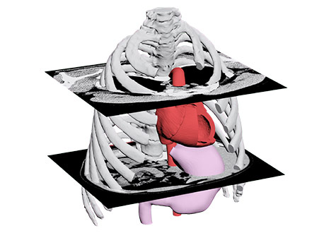 医療用CT・MRIデータからの3Dデータ抽出