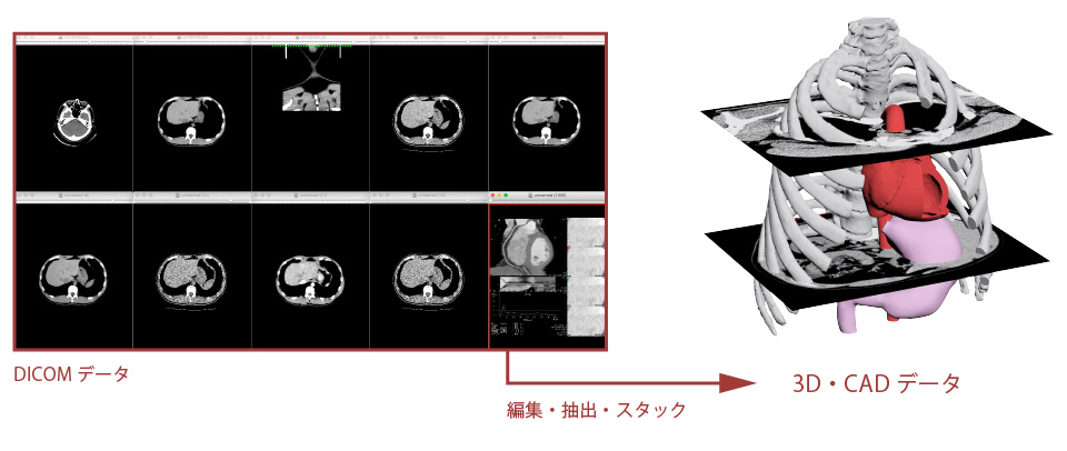 CT撮影から3Dプリンター出力