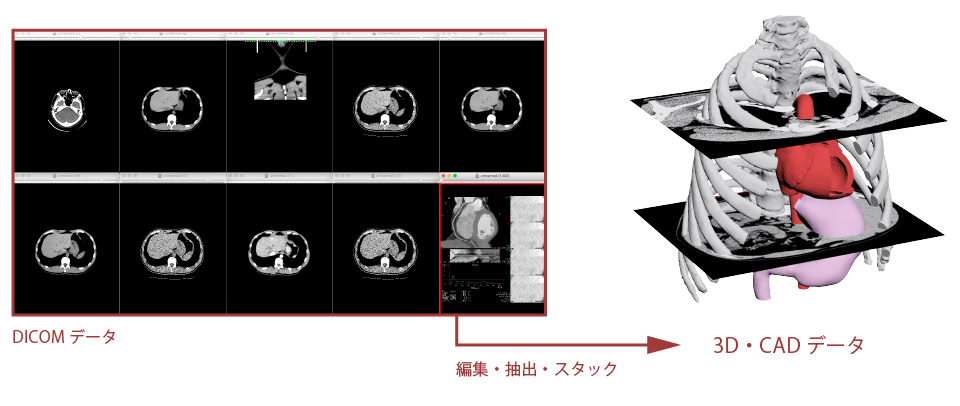 DICOMデータをmimicsに読み込み