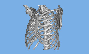 断層画像を3Dデータ化