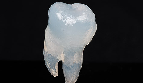 光造形による歯のモデル