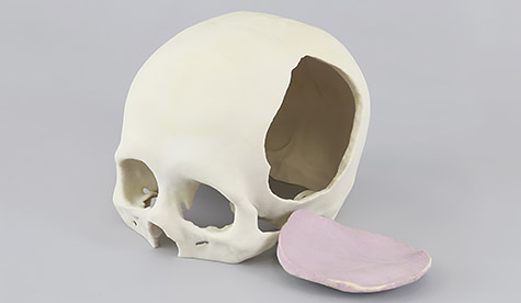 粉末固着造形（石膏）による頭蓋骨模型